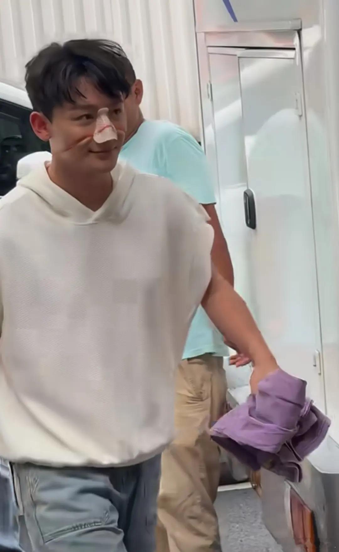 张晚意是拍戏受伤了吗？看起来好严重 