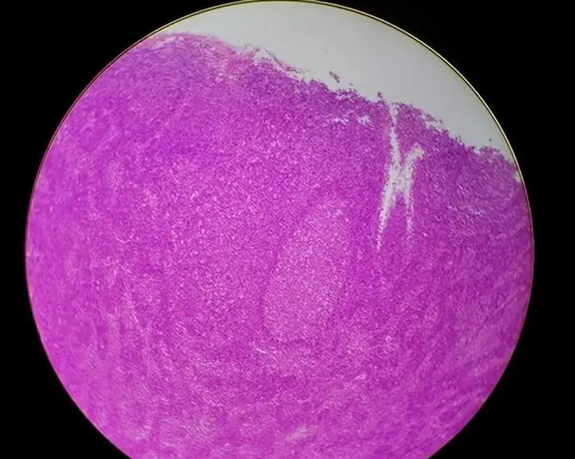 最近很多人做宫腔镜检查时，发现宫腔里长了个小东西，医生说这是“占位”，其实多半就