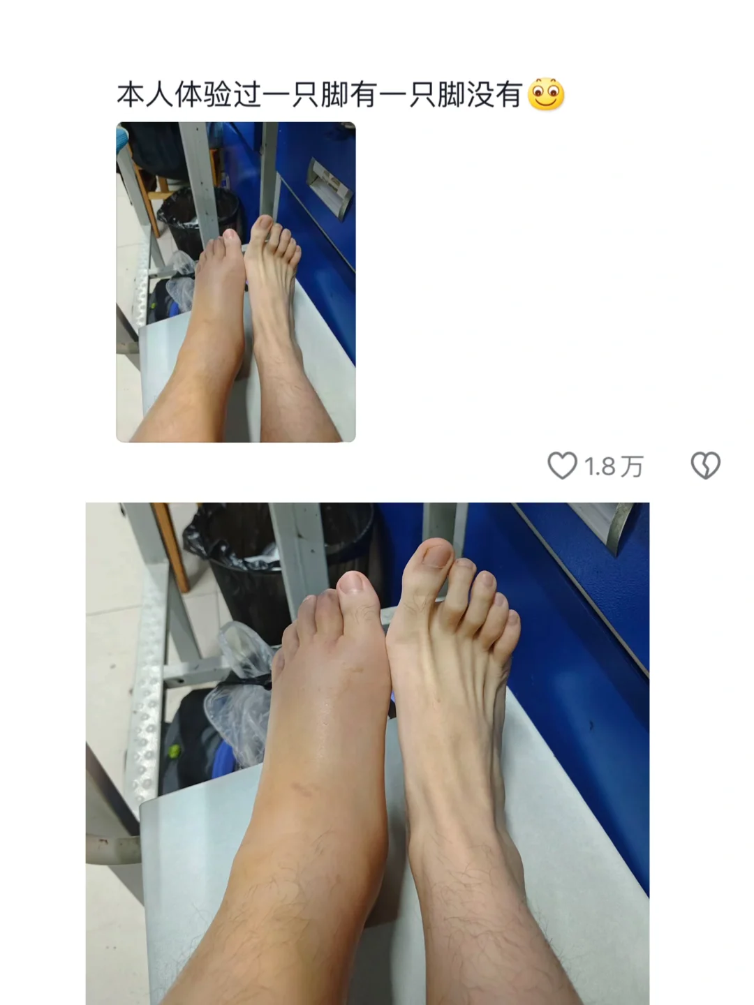 我才知道原来还分有没有脚脖子，你知道么？