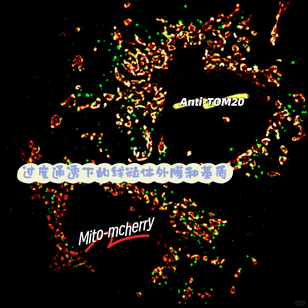 免疫荧光中过度通透对线粒体染色的影响