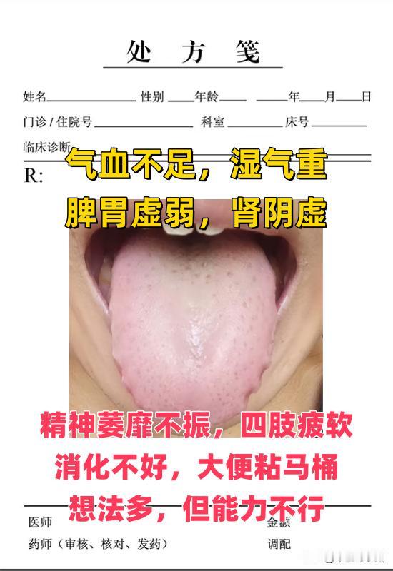 舌诊挑战案例分析：
1、气血不足，湿气重，疲乏困倦脾胃虚弱，肾阴虚
2、心火旺盛