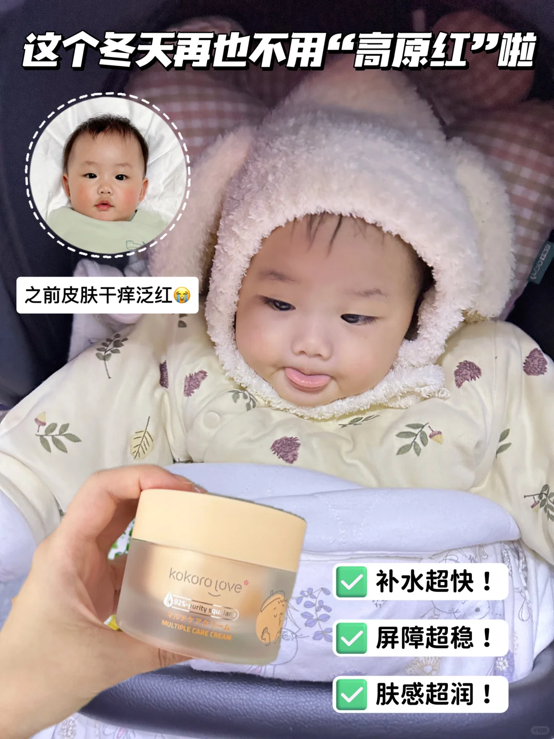 15秒宝宝面霜太牛了！刷新秋冬保湿新高度！