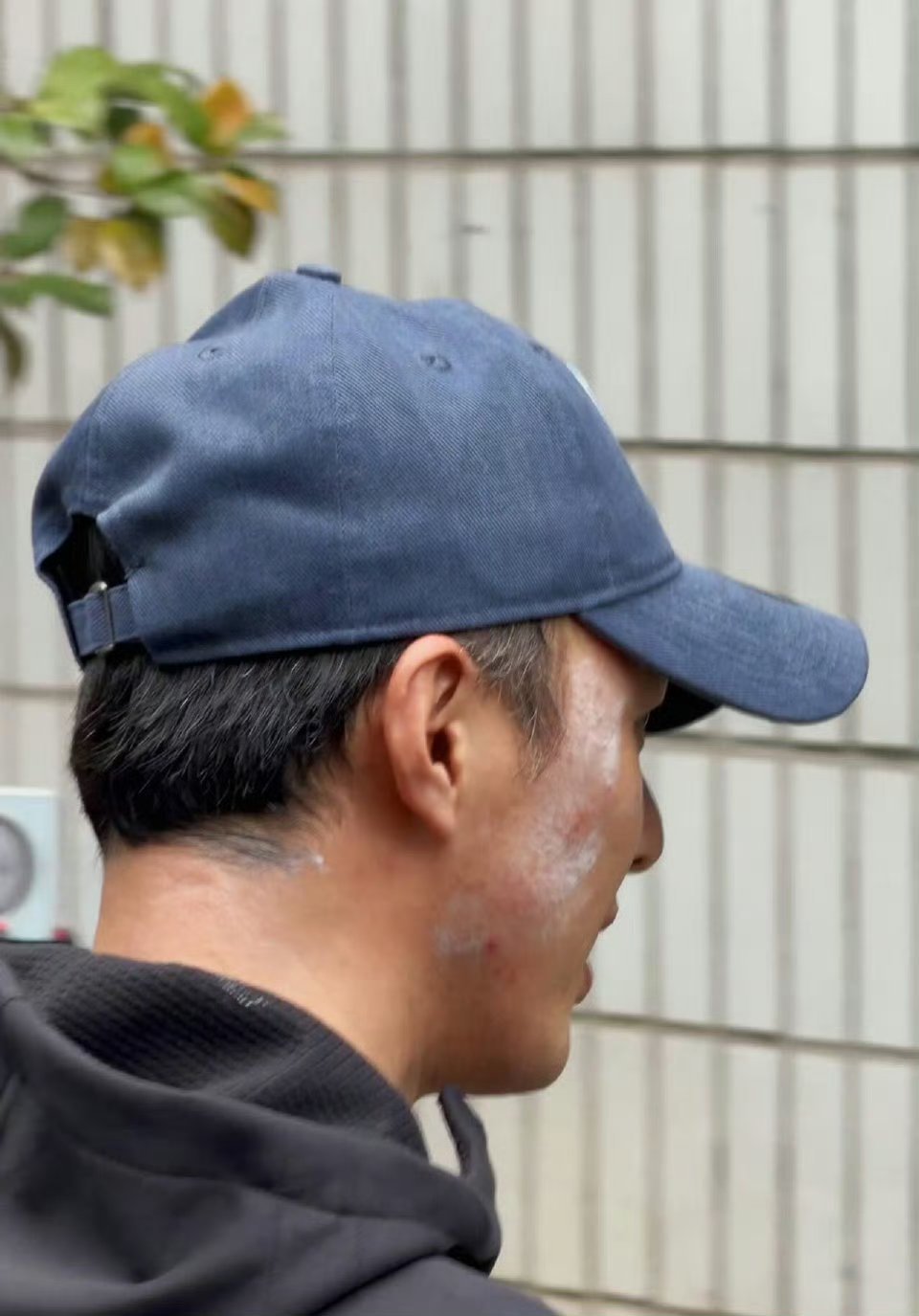 叶祖新的脸怎么了这看着像是头套过敏了，现在天气热了拍古装剧还过敏真的很难受了。 