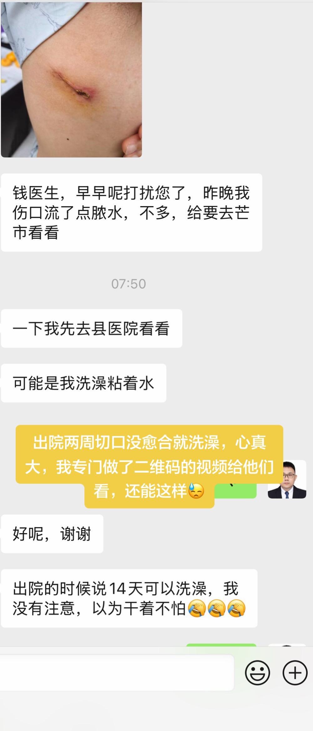 胸部微创手术后，切口完全愈合前，切口不能碰水，不能碰水……夏天汗多，保...