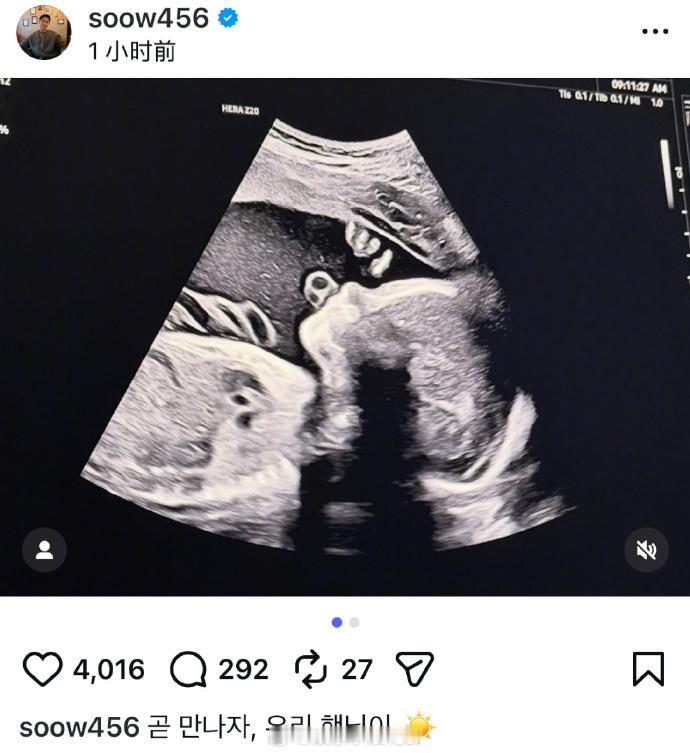 宋承炫当爸宋承炫老婆怀孕 21日，前FTISLAND成员宋承炫晒宝宝B超照，宣布