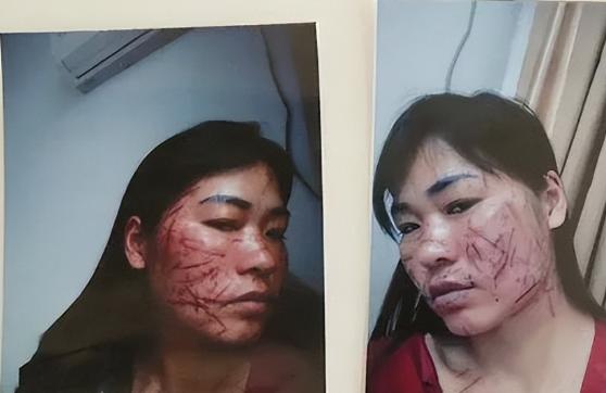 湖南，一女子被小三连着在脸上划了18刀。事后，女子一纸诉状，把重婚的老公送进牢房
