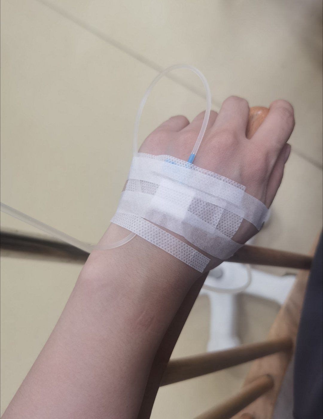 扛不住病得太缠绵去打针了。好消息不是扁桃体化脓感染。坏消息是淋巴结感染先打三天。