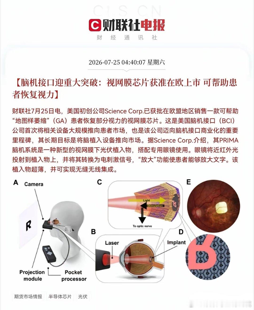 重大消息！重大消息！脑机接口迎来利好消息了，这下好了，满仓脑机接口的要乐开花了，