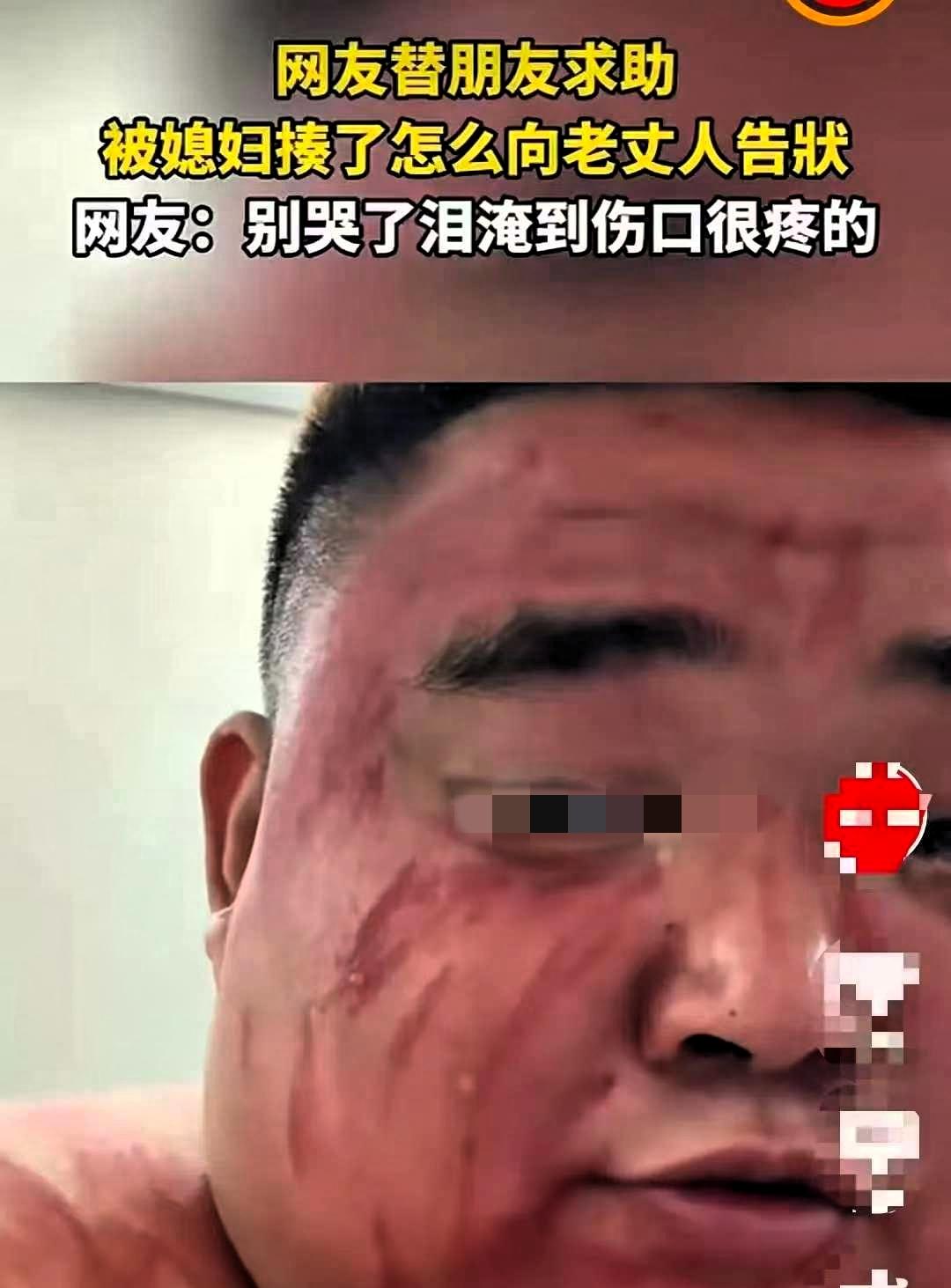 湖北，一男子被媳妇打了，躲到朋友家哭诉，说要去老丈人那告状。谁知，他一连蹲了两天