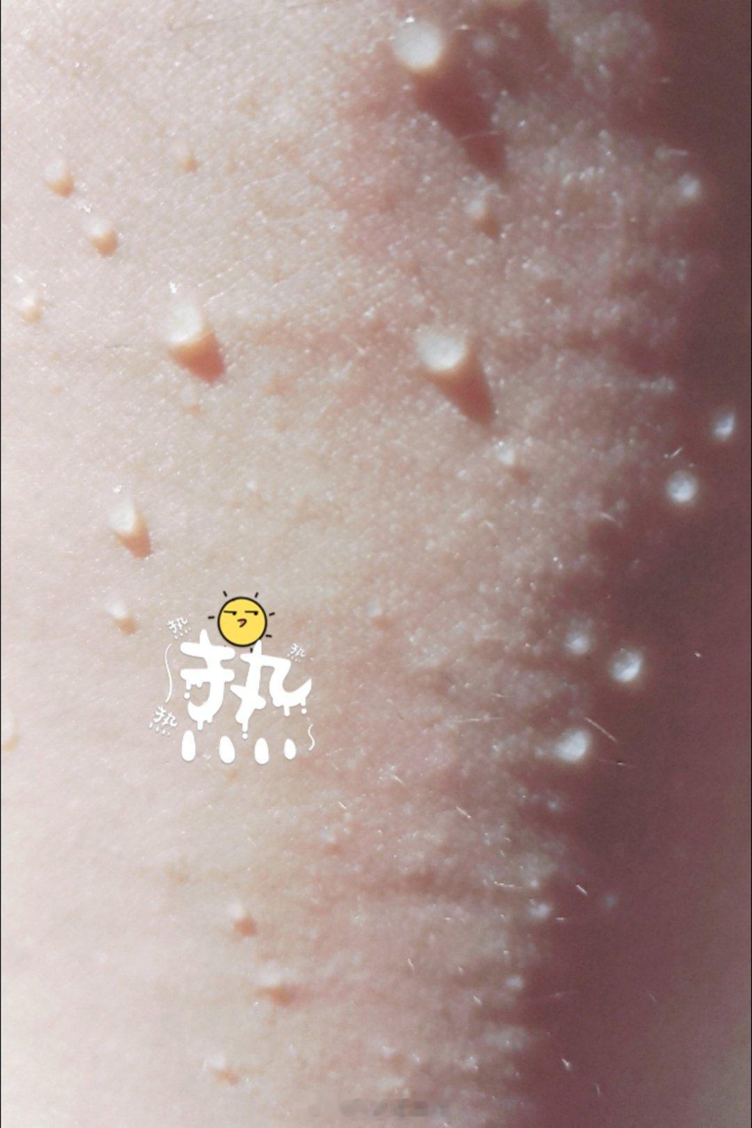 💦热化了别人是出汗，我是全身渗水一样，嘀嗒嘀嗒滴 