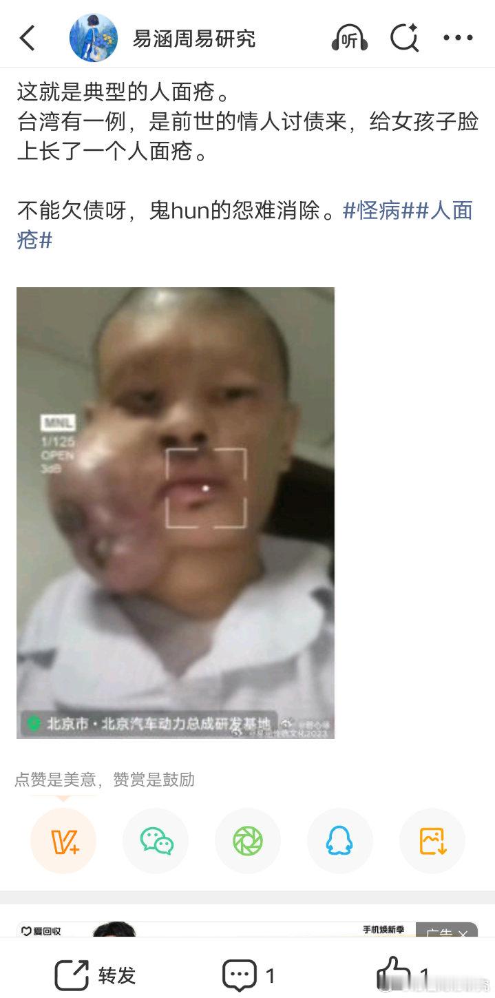 切勿杀生呀，这些都是宿世因果债呀。人面疮。人面疮传统文化[超话]正能量广结善缘传