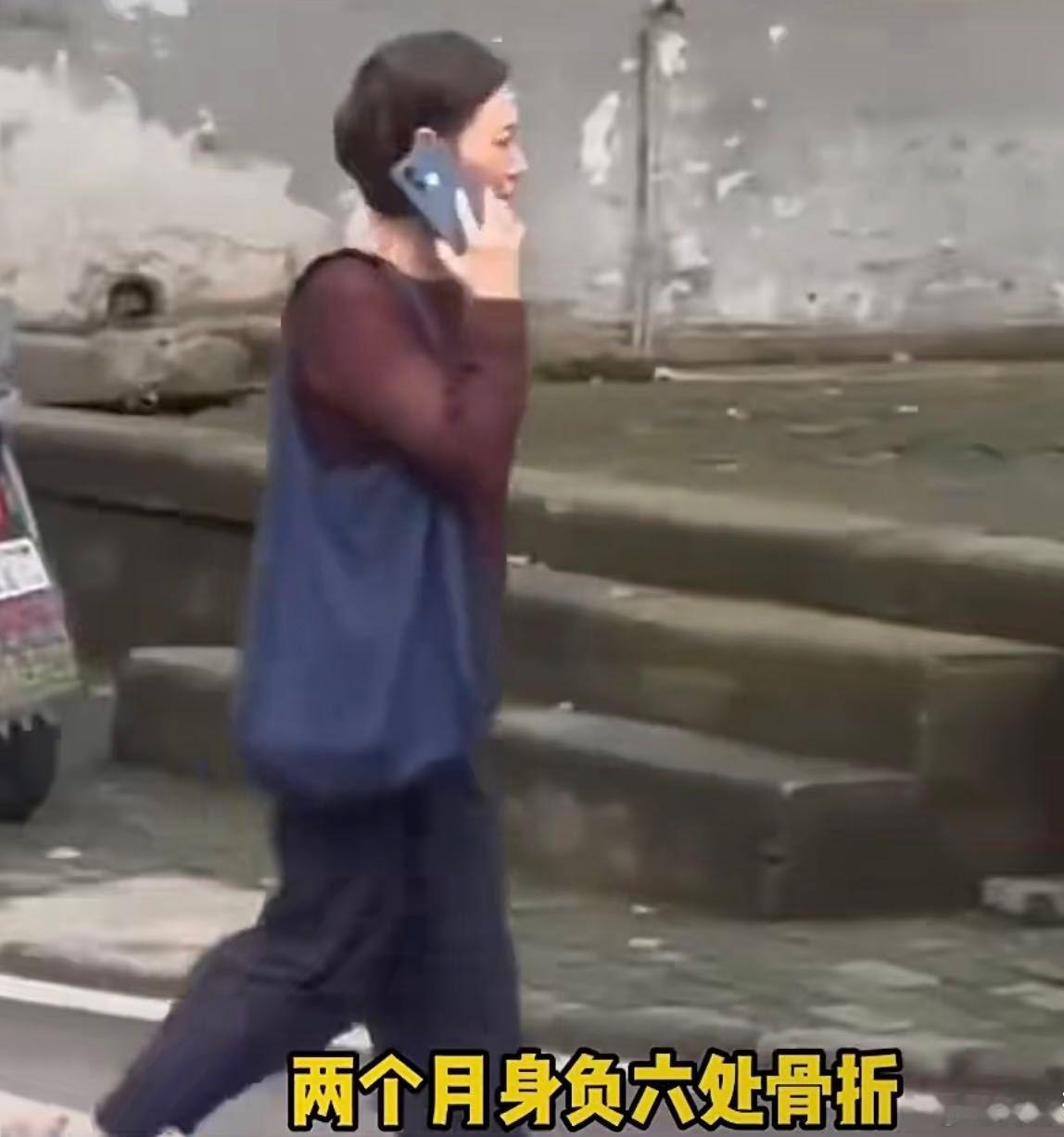 惠英红脸上曾缝过89针  89针没让惠英红退缩，反而成就了她在演艺界的地位。她在