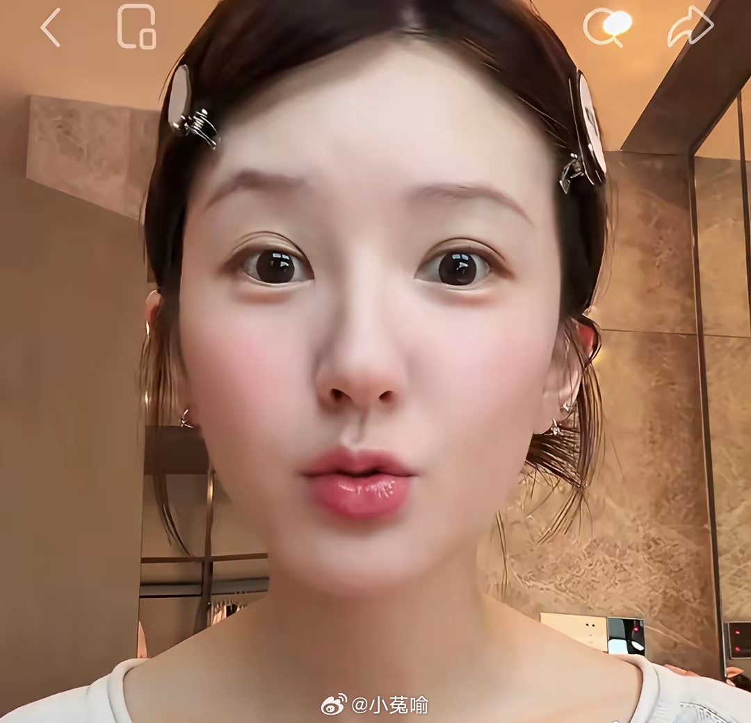 赵露思的唇从韩国回来更加丰满了