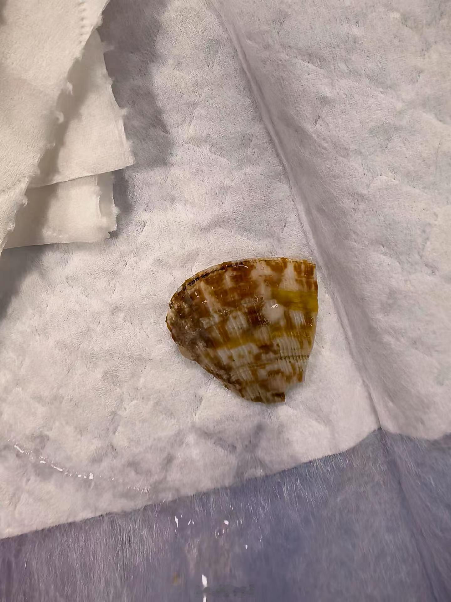 吃饭慢点，别一股脑往里倒，这孩子就让蛤蜊皮卡食道了消化道异物 ​​​