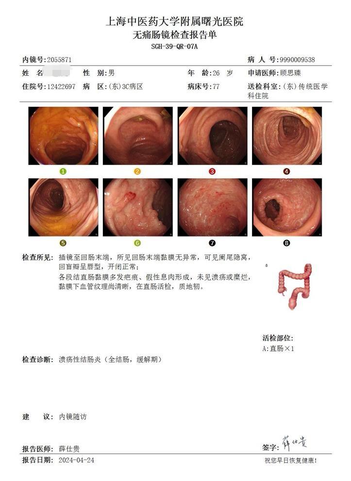 感谢重症溃疡性结肠炎患者馈赠的精美工艺品。