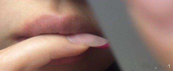 ok呀 泡疹第二天我也是直接快好了（还有点肿本人几乎每年都长一次 每次长了以后很