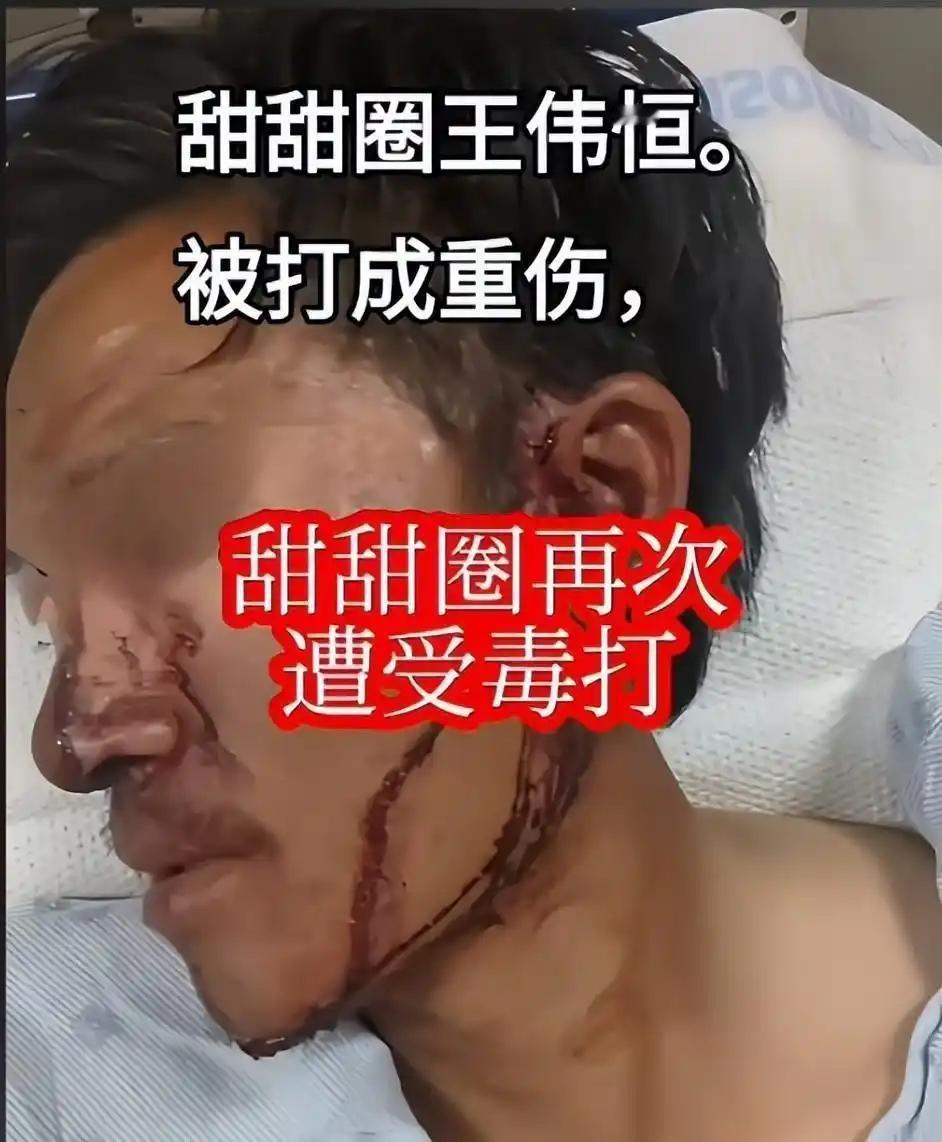 这真是太讽刺了！曾经高喊“甜甜圈真好吃，美国人真好”的王伟恒， 竟然在郊外公园营