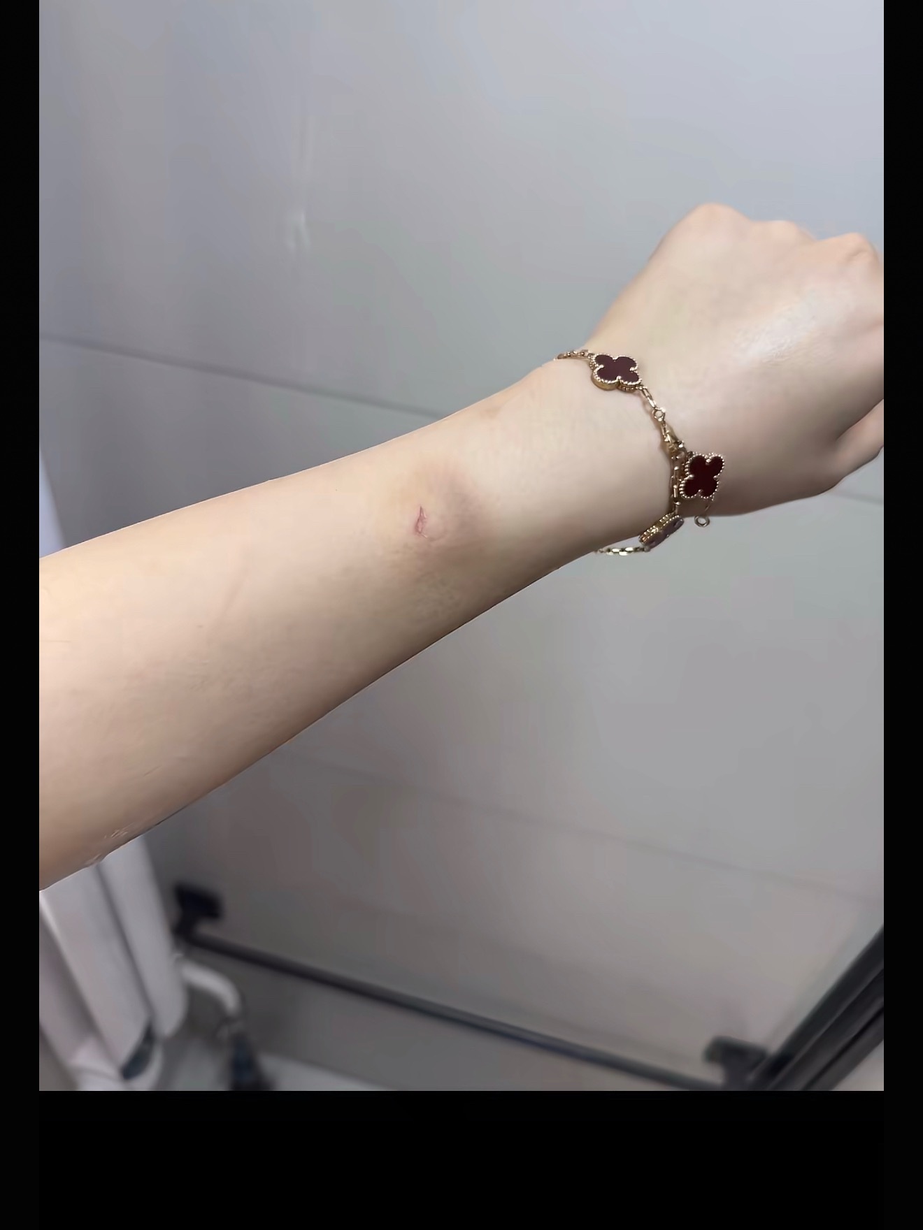 呃呃呃有人刷到这个瓜吗，心动的信号6男嘉宾王垲智被女友齐昕苒锤了，pc和故意伤人