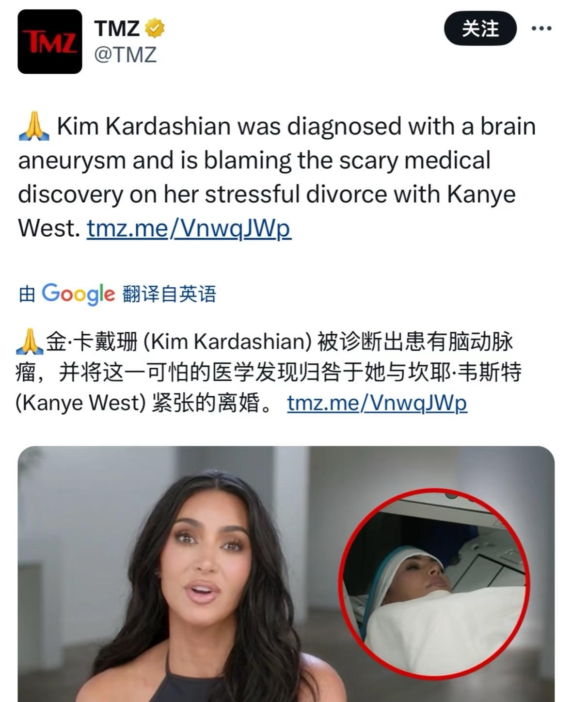 卡戴珊确诊脑动脉瘤。

并归咎于Kanye，那些说别消费ye的，你们不明白人家的