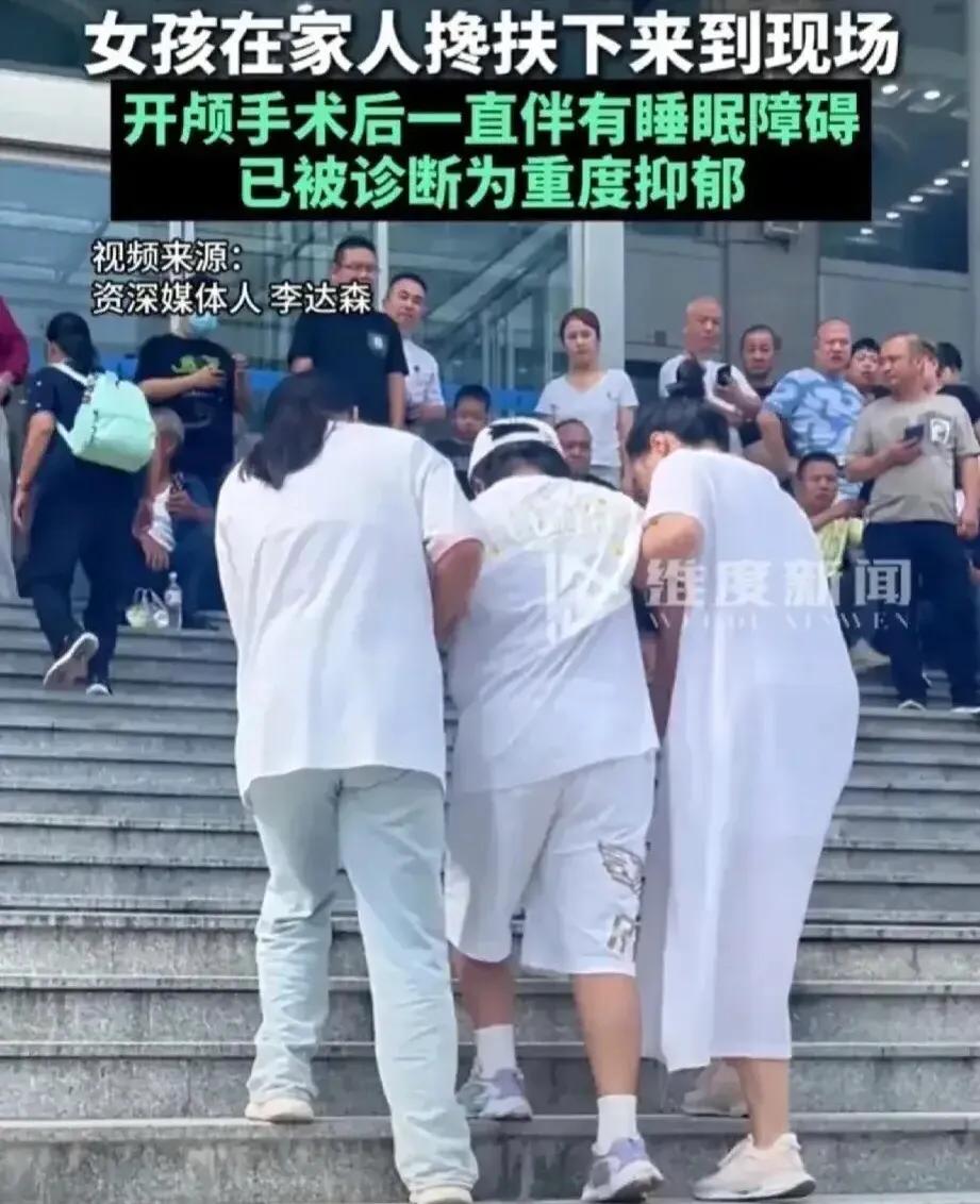 【学生应自求多福自我保护】活泼的女孩居然被老师打破头骨，这代价太大了。维护班级秩