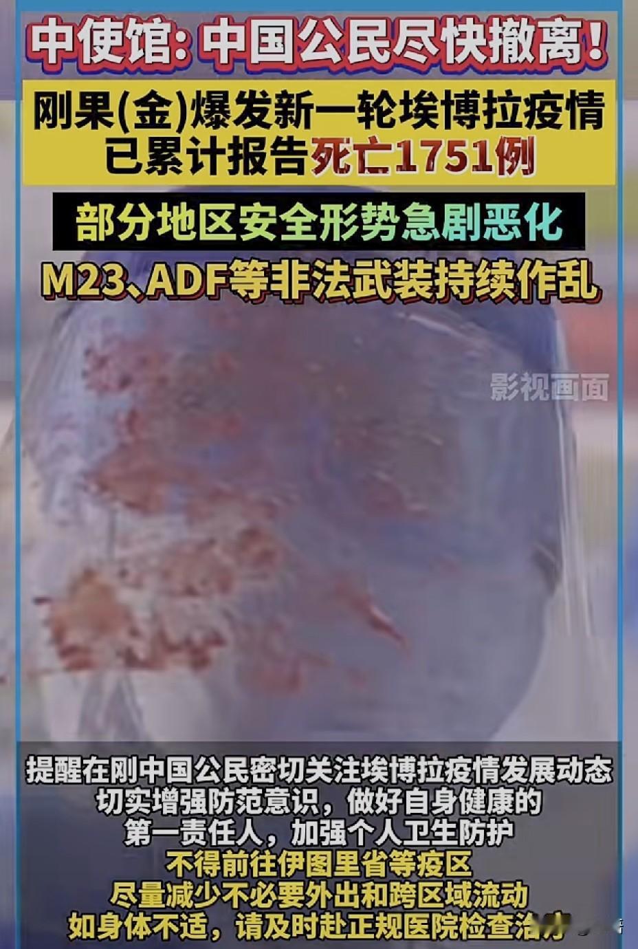 中使馆: 中国公民尽快撤离！刚果(金)爆发新一轮埃博拉疫情，已累计报告死亡175
