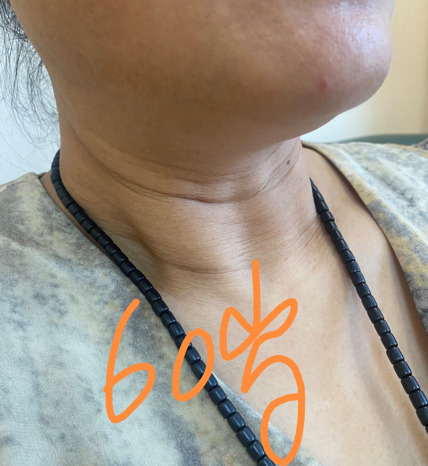 老外热议马克龙这张照片，说他脖子那里的褶皱像面具拼接处一样。看了下他以前就挺明显