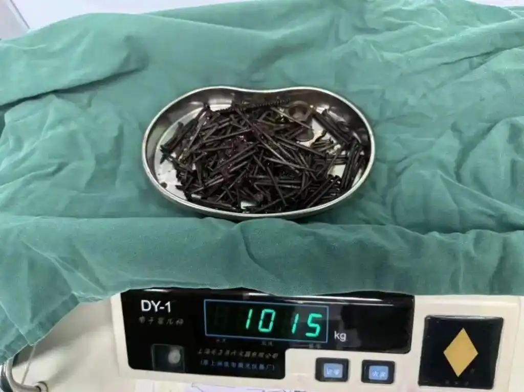 解释不清了！

云南一名36岁男子反复恶心、呕吐，还出现腹痛，家人带他去医院。结