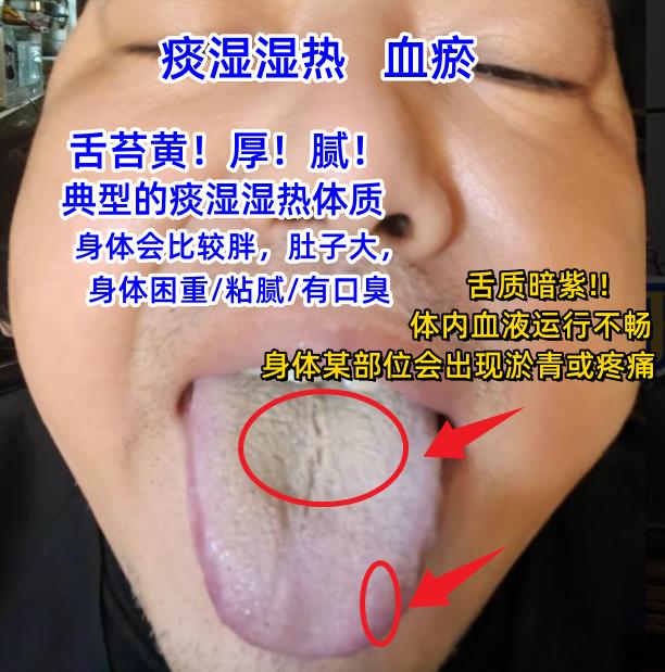 今日舌诊案例分析：内热外寒，阳虚寒湿，阴虚血瘀，肝郁克脾，五脏俱损！[谢谢][谢