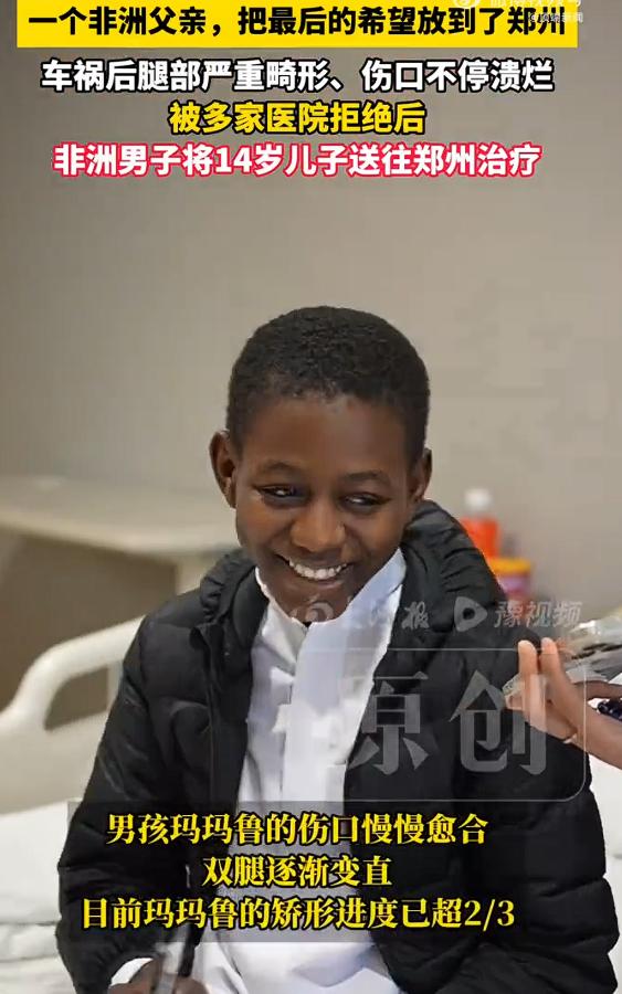 非洲男子将14岁儿子送往郑州治疗，看到小男孩灿烂的笑容，我也替他感到高兴，毕竟，