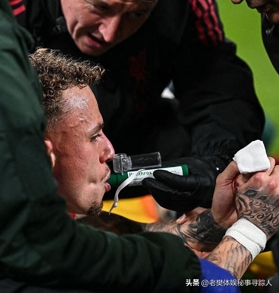 😱 太恐怖！球星热身手指被广告牌夹断，戴氧气罩紧急送医

3月17日英超利物浦