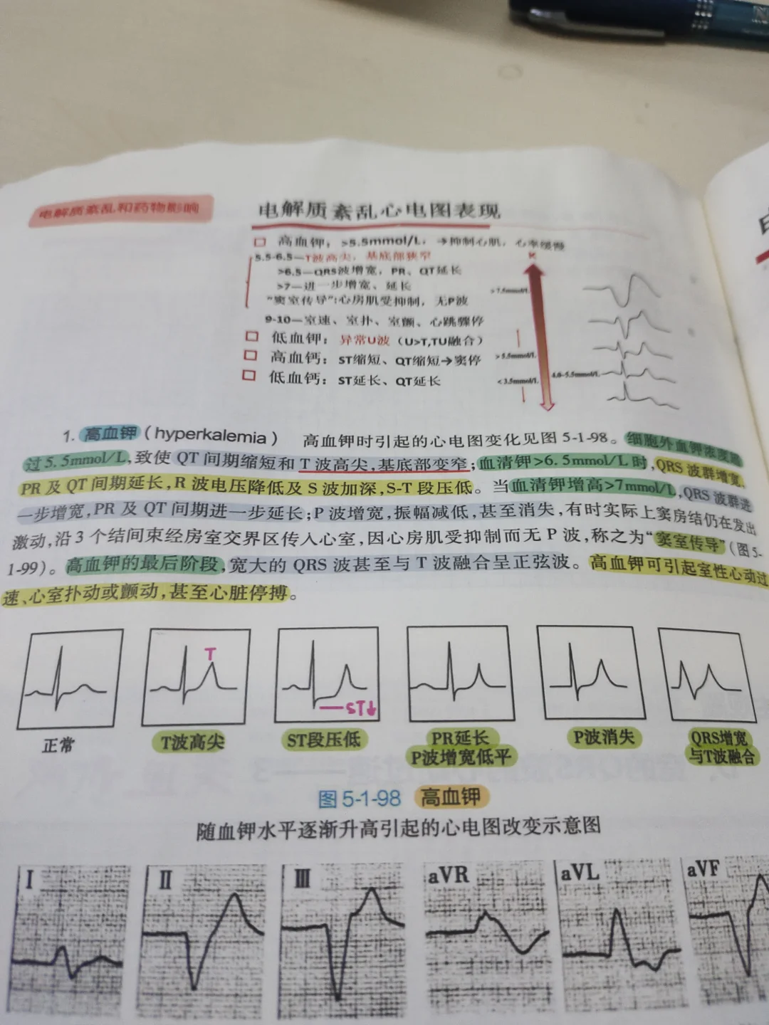 规培医学生心电图17