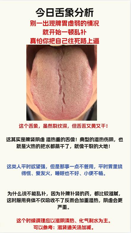 今日舌象分析