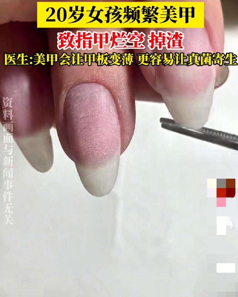 1月11日河南郑州，一位20岁姑娘的事儿在朋友圈传疯了。这姑娘是个美甲狂热爱好者