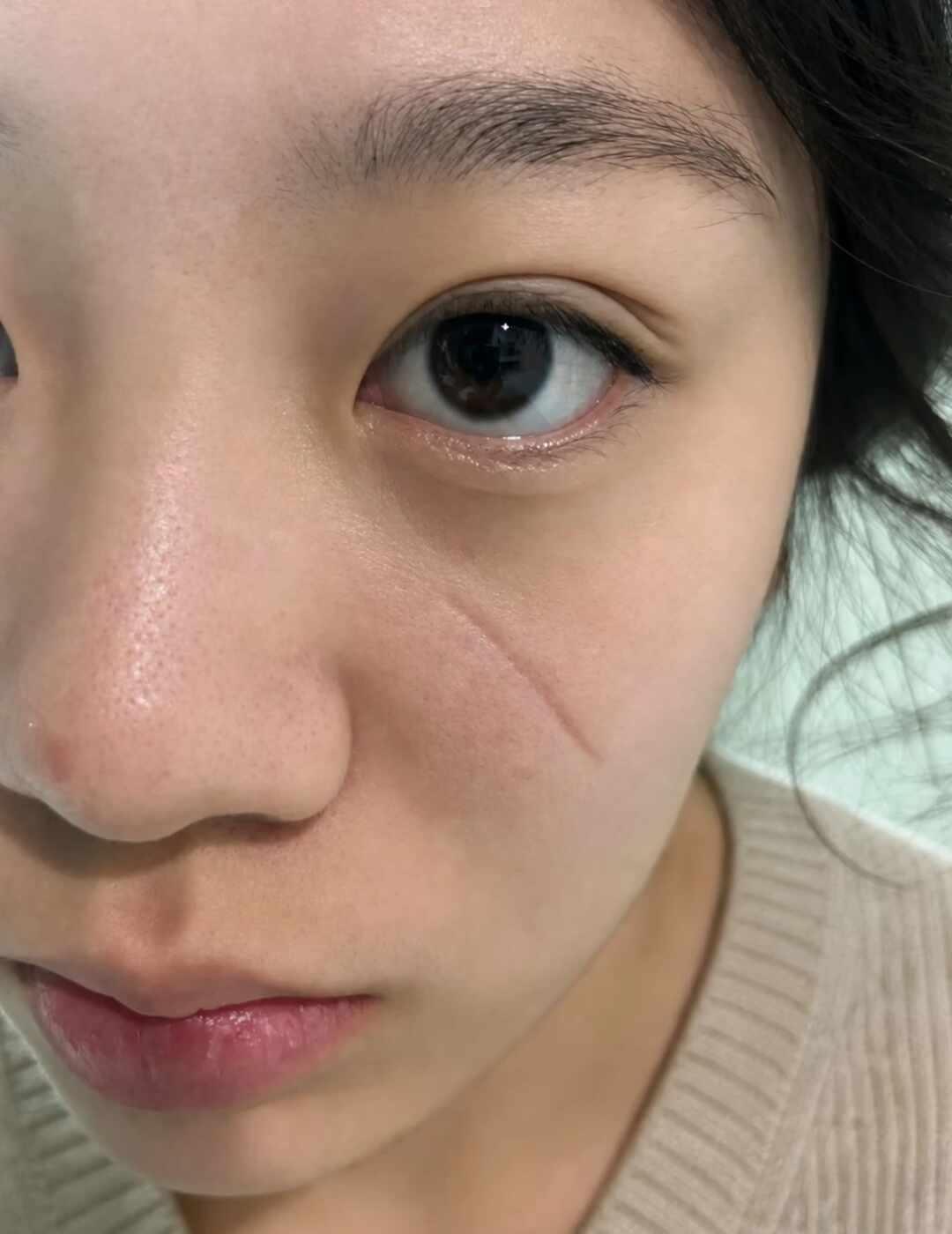 这算逆袭吗？
在广州慢慢完成自我蜕变，告别曾经自卑的自己，容貌和心境一同升级，自