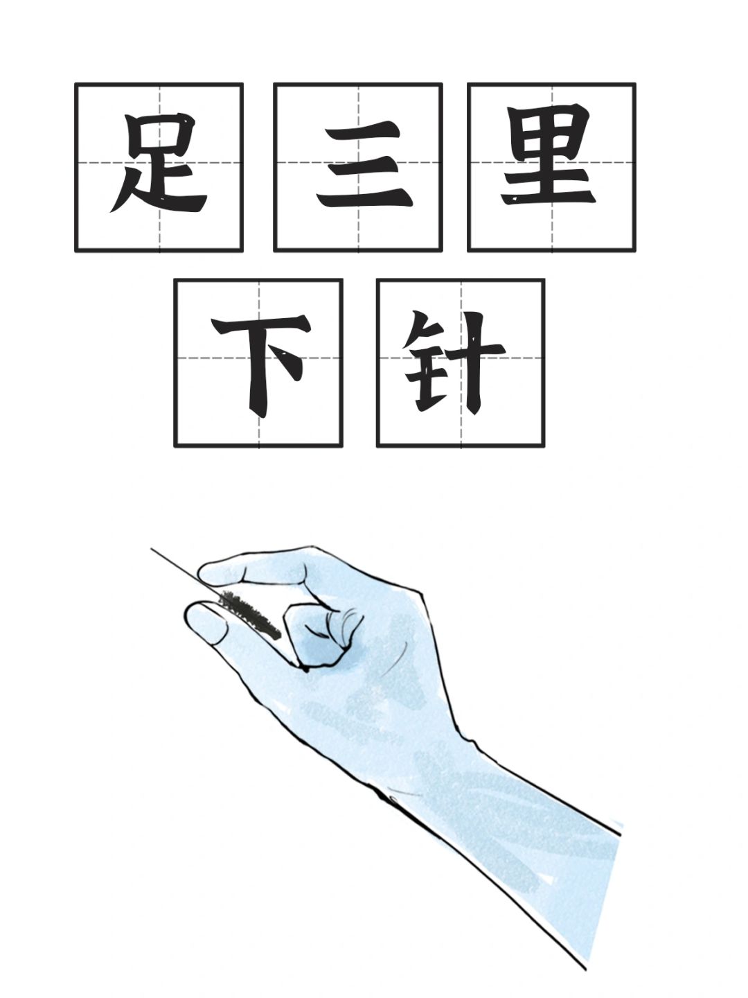 《足阳明胃经》之足三里下针