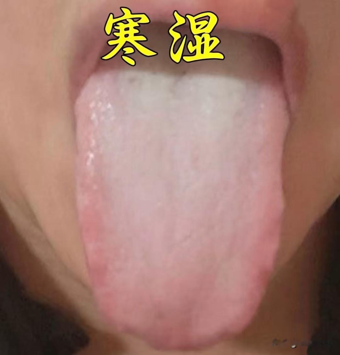 祛湿的关键是先搞清楚寒湿、痰湿和湿热！三个舌象教你快速分辨，精准祛湿！

1.寒