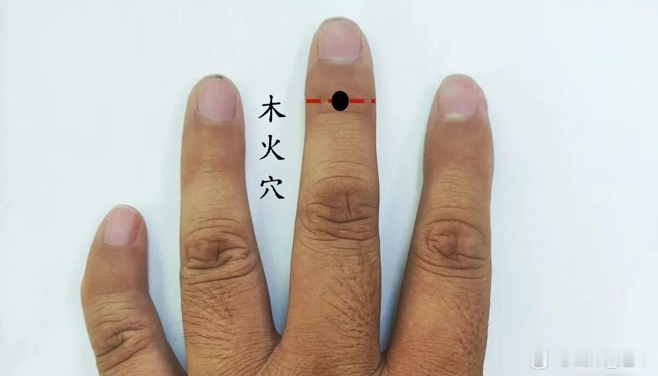 木火穴治疗半身不遂的特效穴 木火穴源于董氏奇穴位置:在中指背第三节横纹中央穴性: