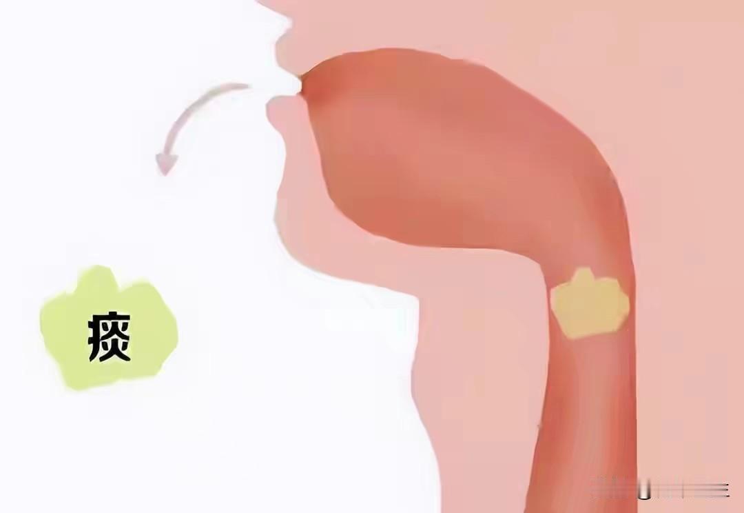 看痰的颜色就能知道病在哪，黑痰、黄痰、白痰到底是什么

民间有这样一句话黄痰轻、