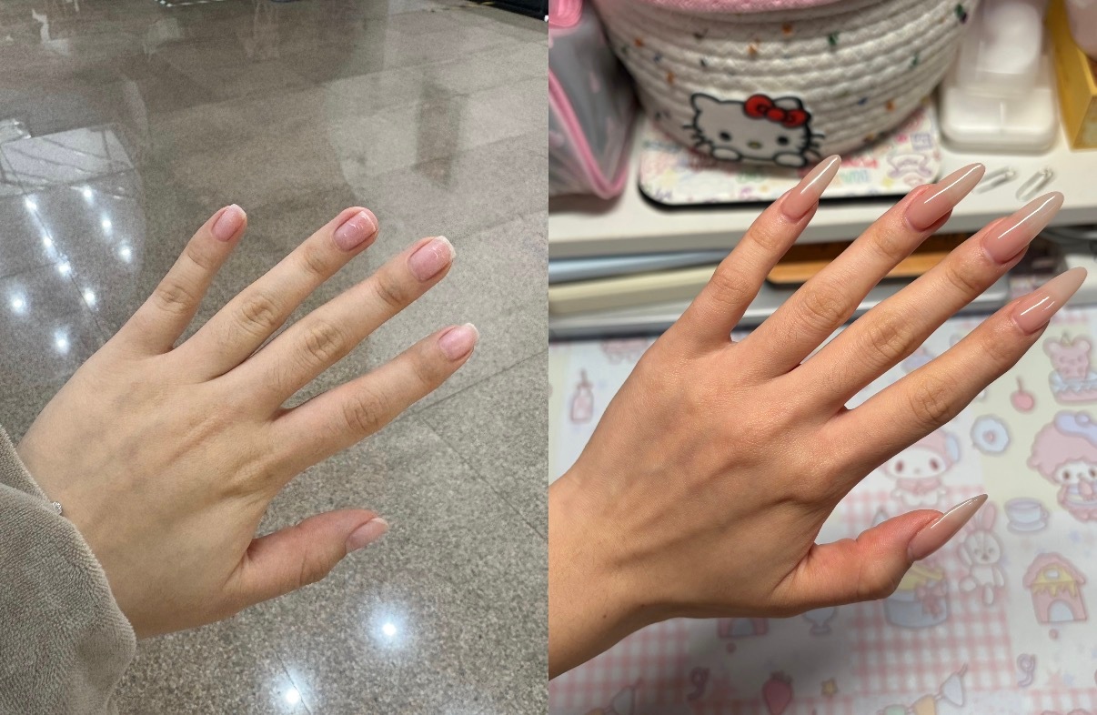 瘦了二十斤后手的变化原来减肥真的瘦全身减肥前126斤，全身上下只有手腕最细，以为