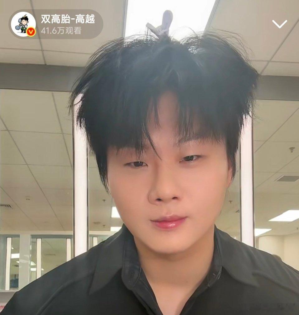 头上戴夹子的小型犬，是说这种嘛？高超这就是你对自己的定位？？ 
