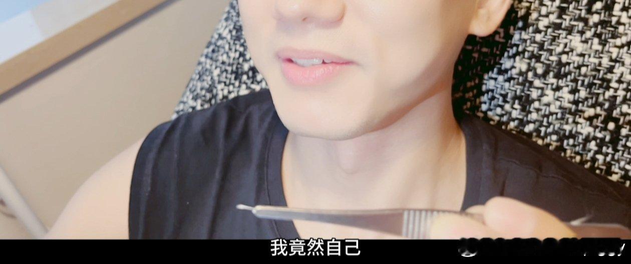 #张杰用镊子给自己拔鱼刺# 我的妈耶🙉张杰也太勇敢了吧，自己给自己夹鱼刺，听着