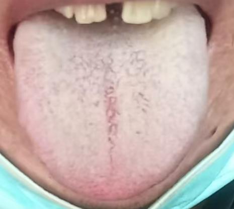 脾肾亏虚影响宗筋状态，益肾健脾是调理关键






如何大幅度提升海绵体的质量