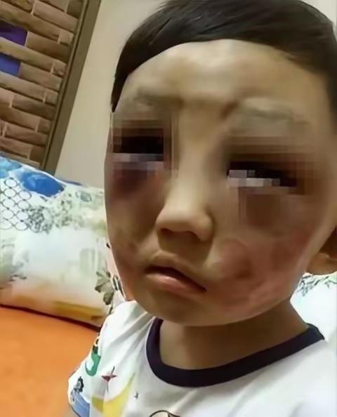 父母离婚6岁的儿子想妈妈，妈妈看到问谁打的。儿子说是那个阿姨，妈妈心疼的抱着儿子