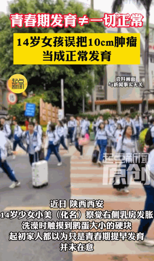 陕西西安，14岁少女胸部单侧发胀凸起，自认是青春期正常发育，家人也笃定是发育期乳
