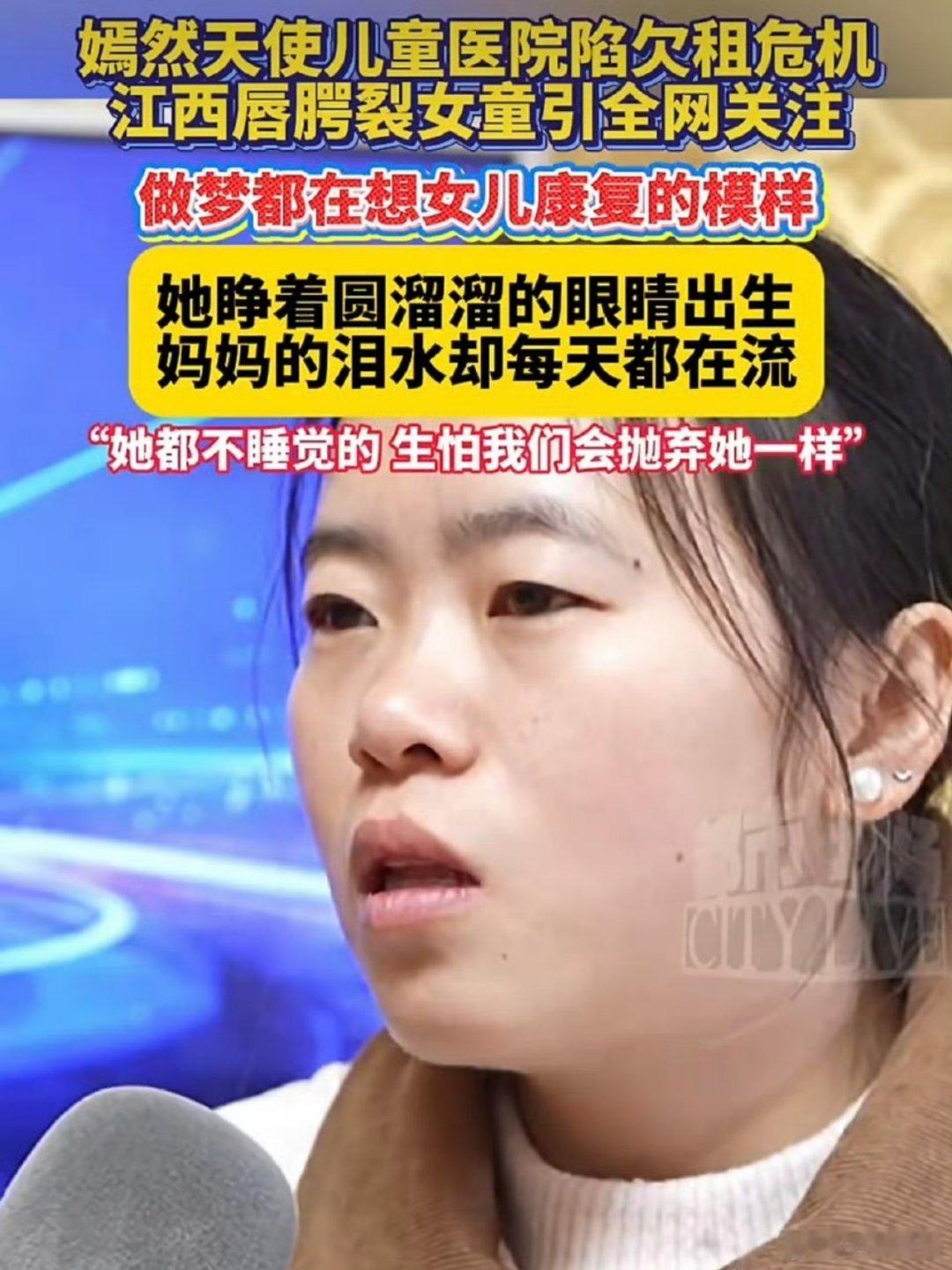 江西唇腭裂女童引全网关注希望小宝贝早日能做手术继续健健康康快乐成长有些评论看不得