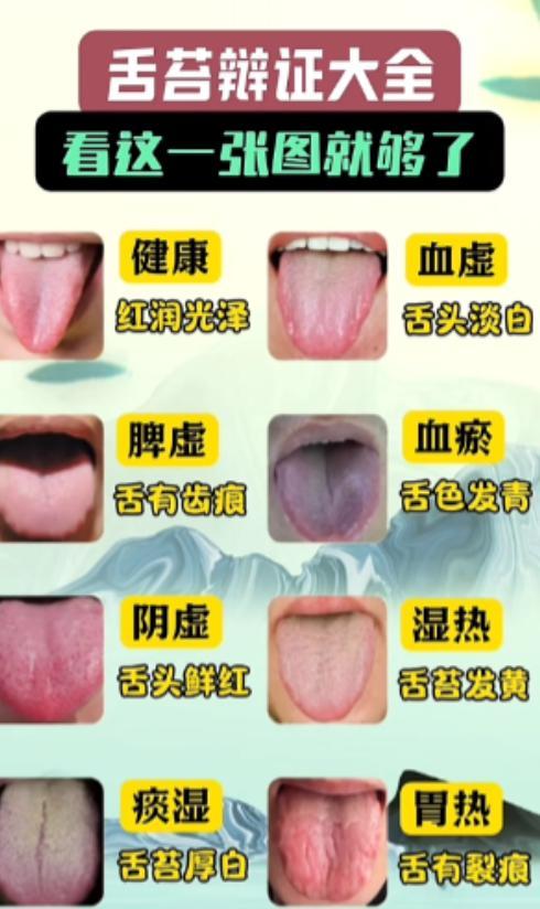 舌苔辨证分析，看下面这张图就足够了！建议收藏！

健康舌——红润有光泽

1. 