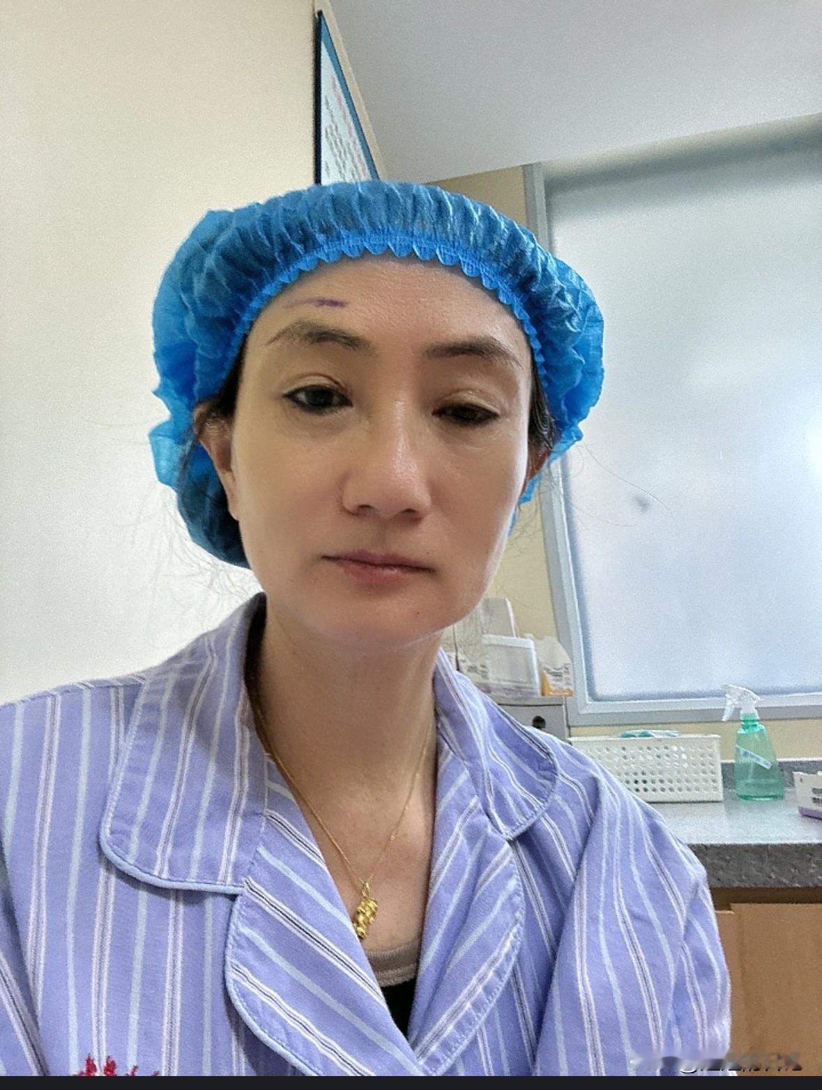 手术室等待中，听着手术室各种仪器声，感觉很紧张。

在紧张也是好事，一次解决总比