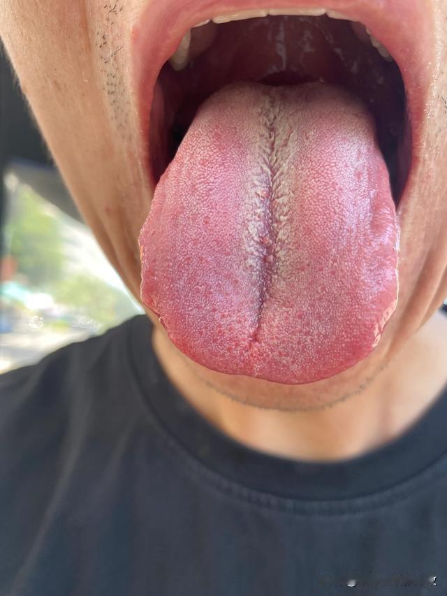 男人遇上裂纹舌，那你就看吧，不是短，就是软[狗头][狗头][狗头]
粉丝主诉：时