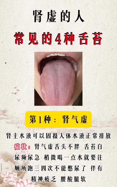 舌苔看肾气：这 4 种表现要留意