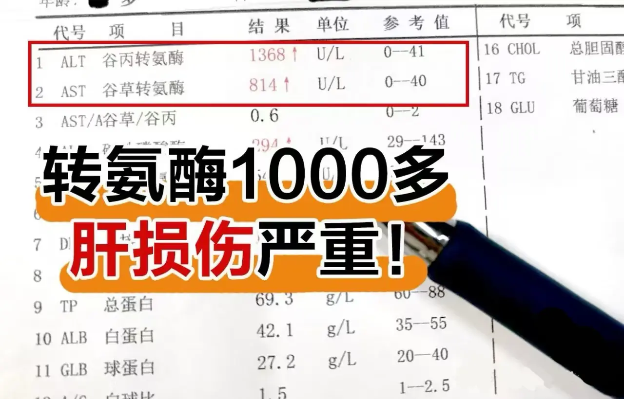 转氨酶1000以上为重度的肝损伤，肝损伤严重，也是肝细胞急性的损伤期...